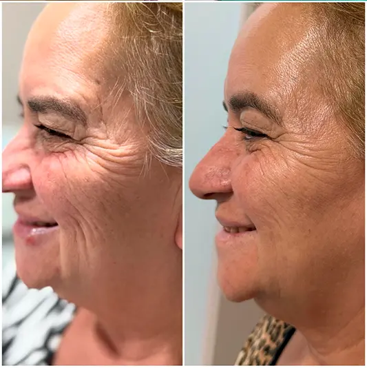 Estética Regenerativa